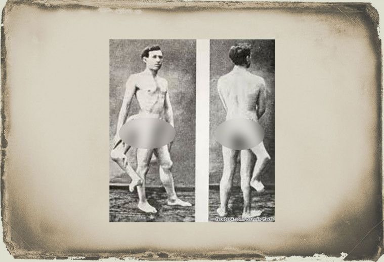 Frank Lentini